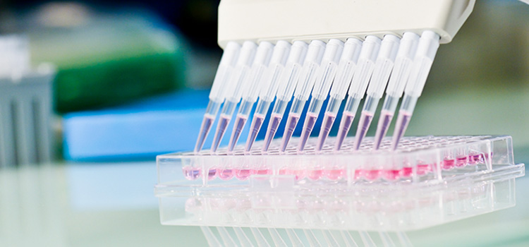 customized-cellular-assays-immunxperts